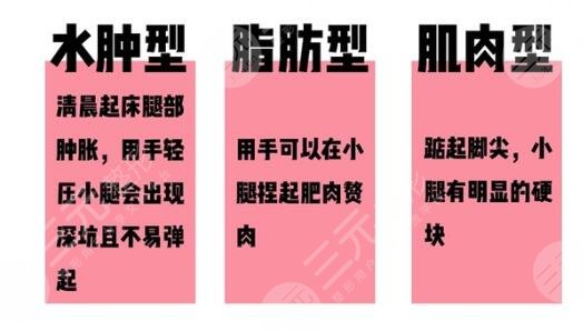 抽脂改良肌肉小腿有哪些注意事項(xiàng)？