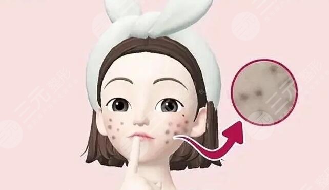 痤瘡疤痕怎么治才能徹底?