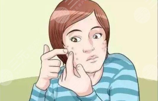 祛痘印案例的介紹