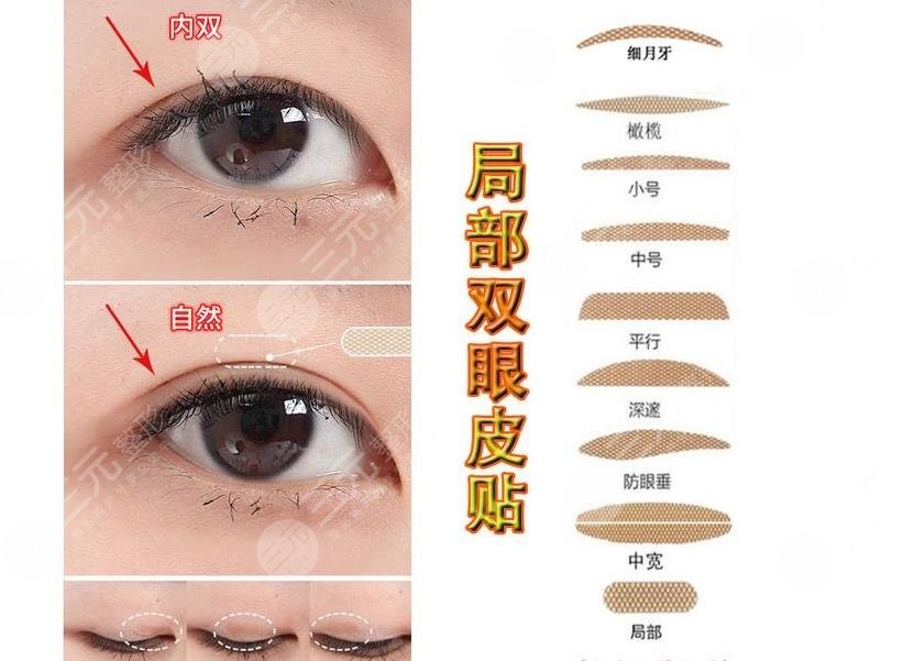 內(nèi)雙怎么貼雙眼皮貼?