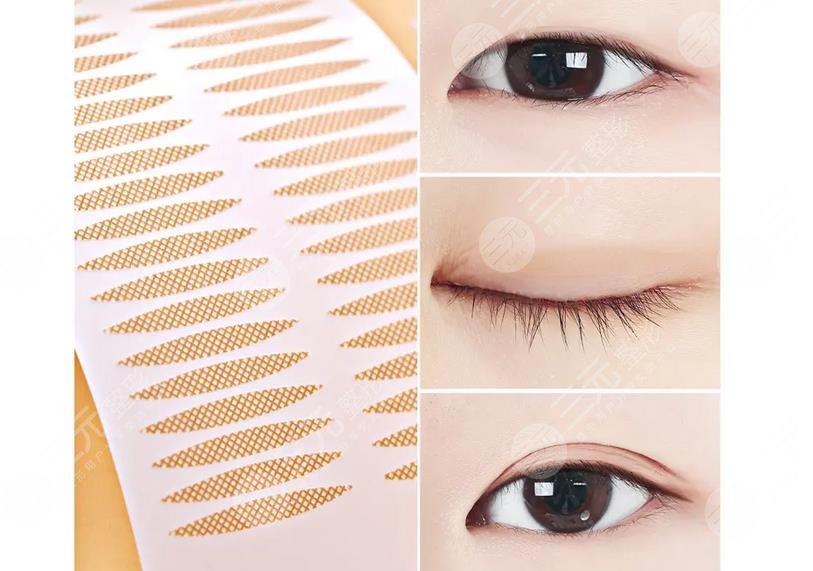 內(nèi)雙適合什么樣的雙眼皮貼呢?