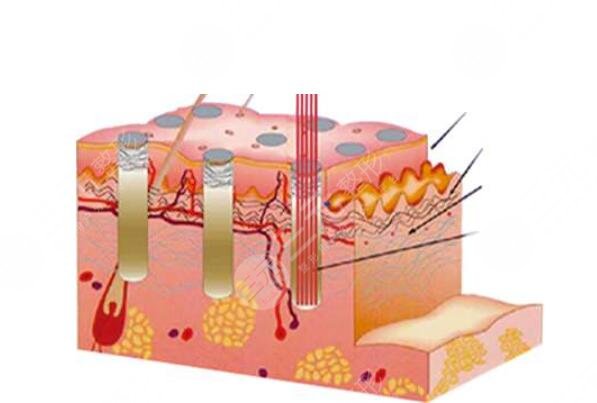 復(fù)合彩光祛痘需要多少錢?