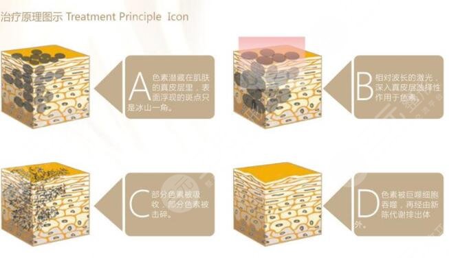 什么是黑臉娃娃?