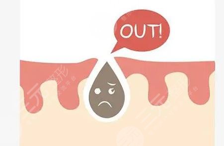 黑頭導(dǎo)出液真的有用嗎?