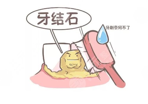 超聲波潔牙可靠嗎？