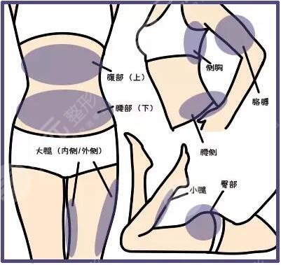 等離子激光溶脂有危害嗎？