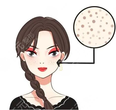 簡單美白的祛斑方法