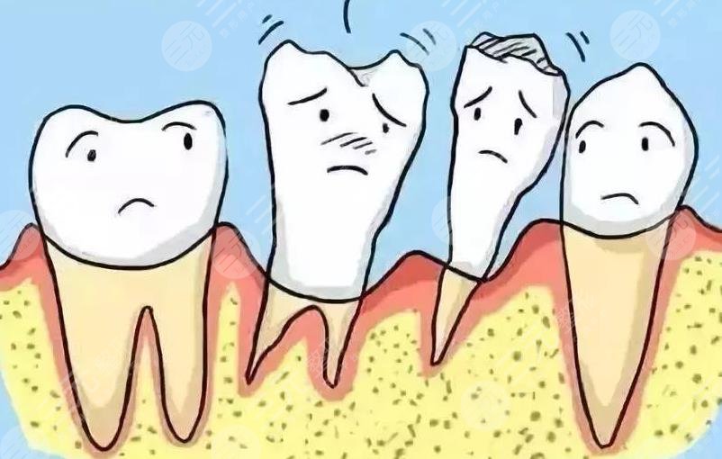 牙周炎牙齒松動原因解析
