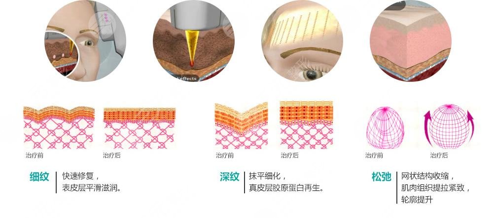 復合彩光緩解多少錢？