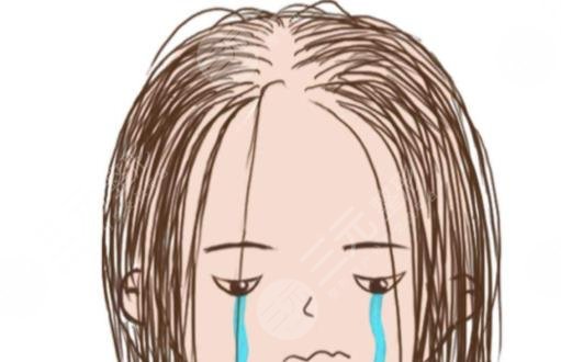 發(fā)際線(xiàn)