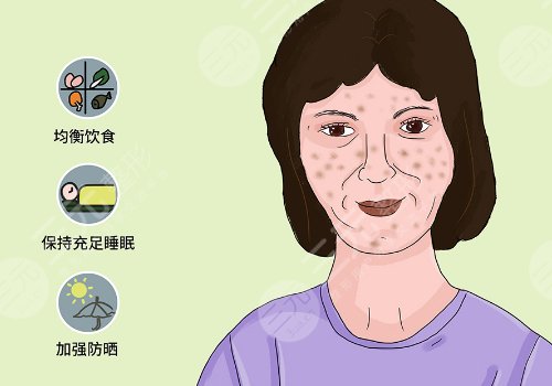 怎樣祛斑果好些?