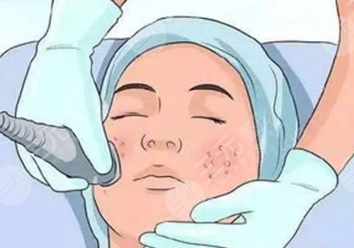 簡(jiǎn)單美白祛斑的方法有哪些？