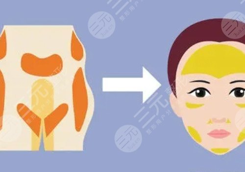 北京歐揚(yáng)醫(yī)療美容診所怎么樣？