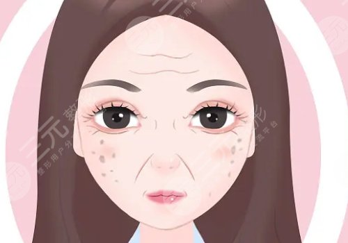 怎樣治老年斑？