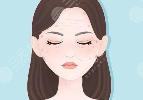 怎樣治老年斑？