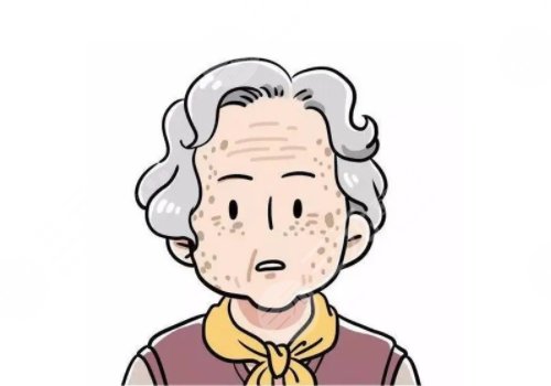 怎樣治老年斑？