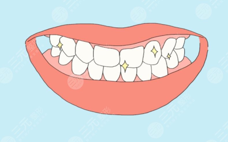 牙齒美白