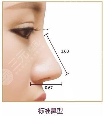 自體軟骨隆鼻特點(diǎn)