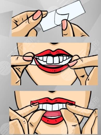 牙貼對牙齒有傷害嗎?