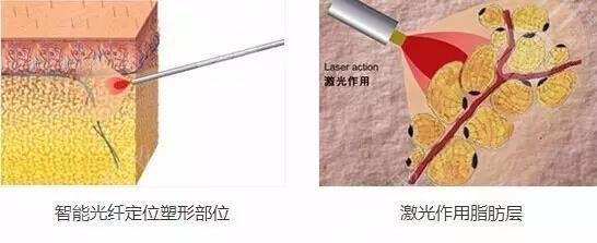 怎樣變瓜子臉？