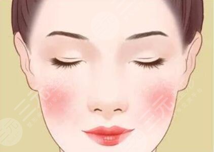 臉上的紅血絲怎么去掉?