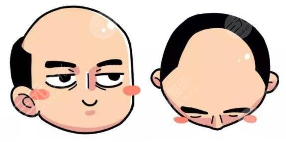 植發(fā)手術(shù)是怎么收費(fèi)的？植發(fā)究竟要準(zhǔn)備多少錢？告訴你真相！