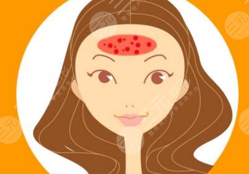 額頭長了很多密密麻麻的小痘痘是什么原因？