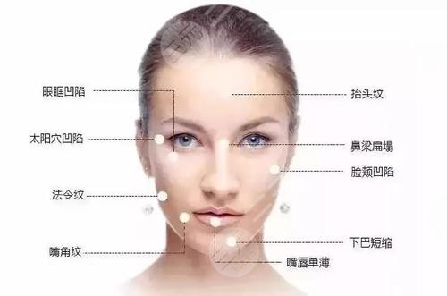 玻尿酸注射的注意事項(xiàng)