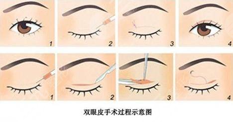 內(nèi)江達芬奇醫(yī)療美容怎么樣？