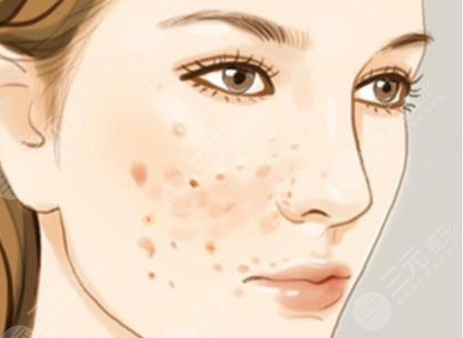 自制祛斑小妙招有哪些？正確的祛斑方式方法，不走彎路！在家就能輕松操作！