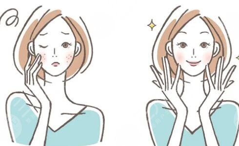 市面上常見祛斑方法