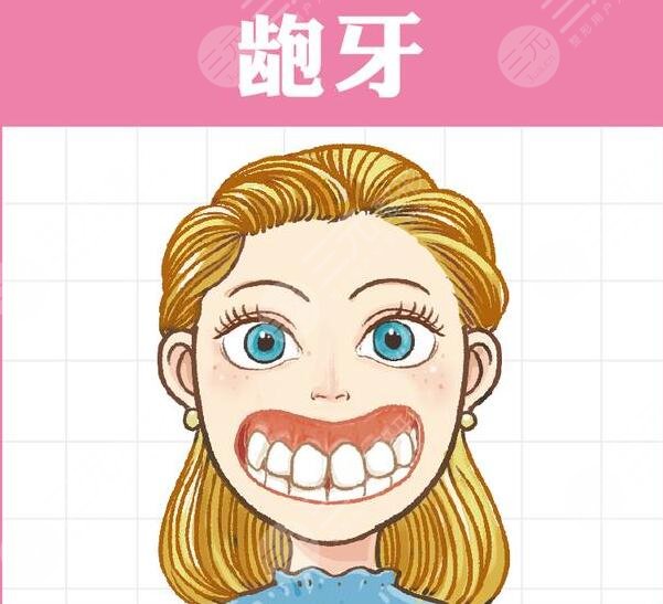 　　美容冠矯正齙牙果嗎?其實(shí)這種緩解能夠讓口腔狀態(tài)更加地正常和協(xié)調(diào)，而且也能夠讓牙齒排列的，更加的精美。通過(guò)做齙牙的矯正緩解，能夠讓整個(gè)人的口腔狀態(tài)看上去更加的自然和協(xié)調(diào)，但是想要通過(guò)做美容冠來(lái)解決自己的齙牙，這種做法是不推薦的，雖然能夠達(dá)到一定的果，但是治標(biāo)不治本，而且，這種緩解方式，并不適用于所有的齙牙。那么，美容冠矯正齙牙果如何?  　　一、美容冠矯正齙牙果嗎?  　　一般情況下，如果齙牙的程度比較輕的話，那么通過(guò)做美容冠緩解能夠達(dá)到一定的果，但是嚴(yán)重的齙牙，做美容冠其實(shí)是沒(méi)有作用的，不能夠達(dá)到齙牙的緩解果。有些輕度的齙牙，做美容冠是有代價(jià)的，而且需要在專(zhuān)業(yè)醫(yī)生的指導(dǎo)下磨出一部分牙齒組織，讓牙齒變得更小，然后重新套一個(gè)冠下去，并且，套一個(gè)可能沒(méi)那么齙的固定冠下去，所以說(shuō)這種方式有一定的局限性，而且是不值得推薦的。  　　二、齙牙如何緩解?  　　齙牙的緩解方式主要分為拔牙和牙齒矯正，尤其是隱形正畸手術(shù)或金屬正畸手術(shù)。有齙牙的患者，建議去做正畸緩解，通過(guò)做該緩解，能夠讓牙齒排列的更加的正。或者如果嚴(yán)重，還可以去專(zhuān)業(yè)的醫(yī)院完成正頜外科方面的手術(shù)，包括聯(lián)合箍牙、矯牙的緩解來(lái)進(jìn)行矯正。  　　1、做拔牙緩解。其實(shí)拔牙緩解能夠讓整個(gè)人的口腔狀態(tài)看上去更加的美觀，而且拔出了大多數(shù)的牙齒之后，整個(gè)人的口腔狀態(tài)也會(huì)更加的協(xié)調(diào)齙牙的存在，也能夠得到更好的改良。  　　2、做牙齒矯正手術(shù)。做牙齒矯正手術(shù)，包括隱形正畸手術(shù)和金屬正畸手術(shù)，而且需要佩戴牙套，再佩戴了牙套之后牙齒才會(huì)排列的，更加的整齊和美觀。一般分為隱形的牙套和金屬的牙套，隱形的牙套是可以自行摘戴的，而且美觀都是相對(duì)較好的，雖然金屬牙套不能夠自行摘戴，但是能夠起到更好的塑形果，其實(shí)也是一種不錯(cuò)的操作。在佩戴牙套大概一年左右的時(shí)間再取下來(lái)，整個(gè)人的口腔狀態(tài)看上去就會(huì)更加的美觀，并且牙齒也會(huì)更加的自然和協(xié)調(diào)，一般不會(huì)出現(xiàn)劇烈的刺痛感和疼痛感，但是需要對(duì)口腔進(jìn)行一定的護(hù)理。  　　3、做正頜手術(shù)。做任何手術(shù)能夠讓牙齒排列的更加的整齊，也能夠讓整個(gè)人的牙槽骨看上去更加的自然和協(xié)調(diào)，做完緩解之后牙齒是一般不會(huì)脫落的。  　　三、美容冠矯正齙牙的注意事項(xiàng)  　　其實(shí)，做牙齒方面的緩解一定要找專(zhuān)業(yè)的醫(yī)生進(jìn)行操作，不能夠盲目的開(kāi)展緩解。而且做完緩解之后，也要多吃新鮮的蔬菜和水果，少吃辛辣油膩以及刺激性的食物，不能夠經(jīng)常熬夜，否則可能會(huì)影響自己牙齒的恢復(fù)。同時(shí)也要注重自己日常的口腔清潔和護(hù)理，如果出現(xiàn)了牙菌斑滋生的現(xiàn)象，那么就要找醫(yī)生進(jìn)行一定的緩解，不能夠經(jīng)常不刷牙，否則可能會(huì)導(dǎo)致牙齒細(xì)菌增多影響口腔的健康。