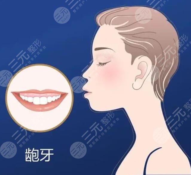 齙牙如何緩解?