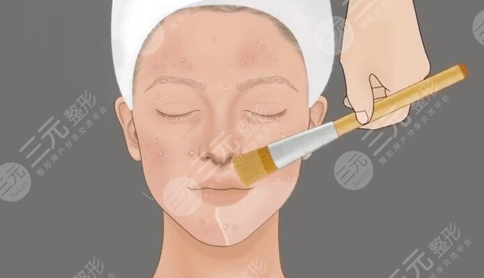 果酸美白的效果怎么樣?