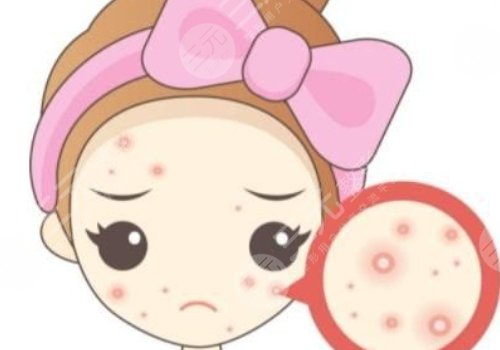 什么藥祛痘印痘坑效果好