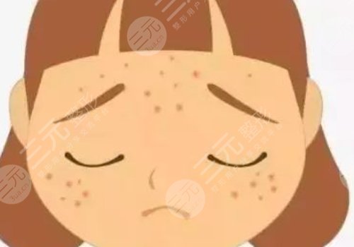 什么藥祛痘印痘坑效果好