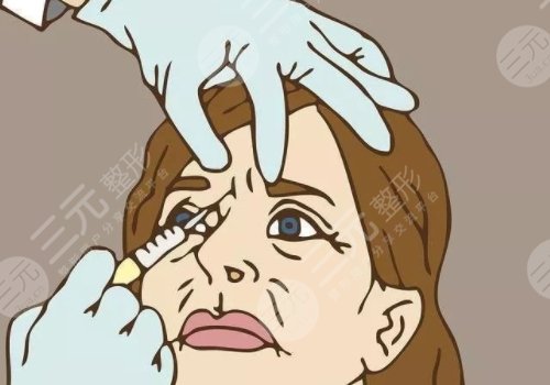 瑞蘭2號玻尿酸多少錢？