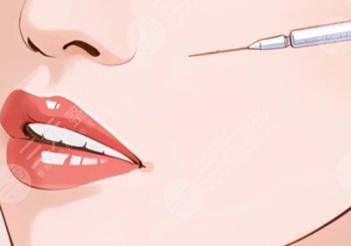 瑞蘭2號玻尿酸多少錢？