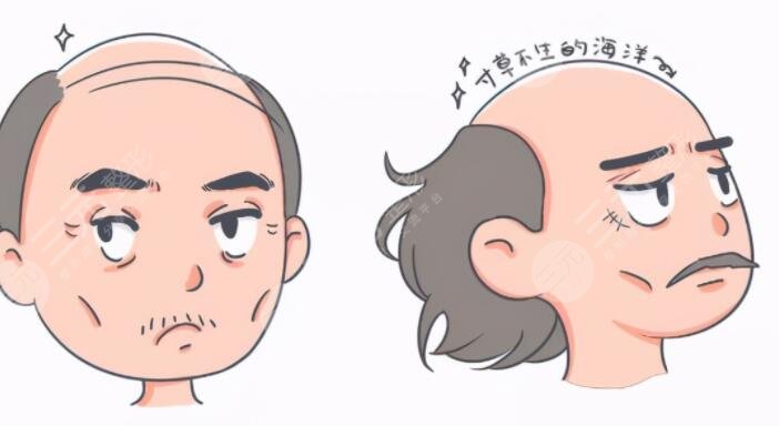 生姜能緩解脫發(fā)嗎？怎么正確使用不傷頭皮？詳細(xì)操作方法告訴你！