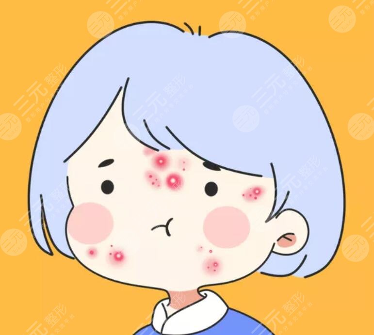 去痘印的注意事項(xiàng)