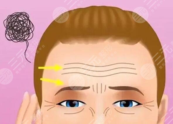 怎么樣去掉抬頭紋有效的小妙招！提醒您這幾種方式有效！網(wǎng)友們都愛！