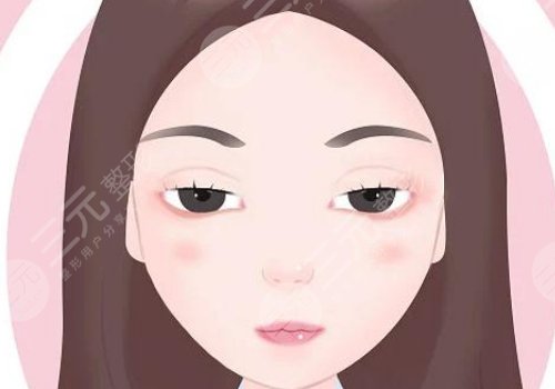 上瞼下垂矯正大概需要多少費(fèi)用?