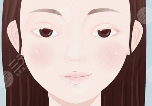 上瞼下垂矯正大概需要多少費(fèi)用?