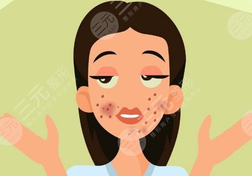 激光祛痘坑痘印有沒(méi)有危害?