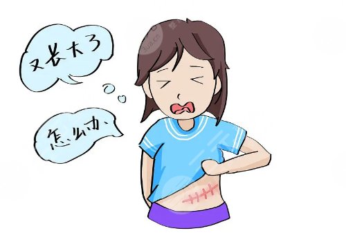 激光去疤痕需要幾次才能徹底消除？