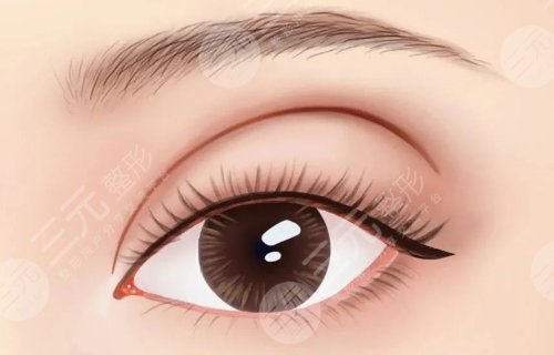 割雙眼皮有什么危害或者后遺癥?