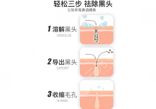 黑頭導出液真的有用嗎?