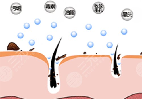 黑頭導出液真的有用嗎?