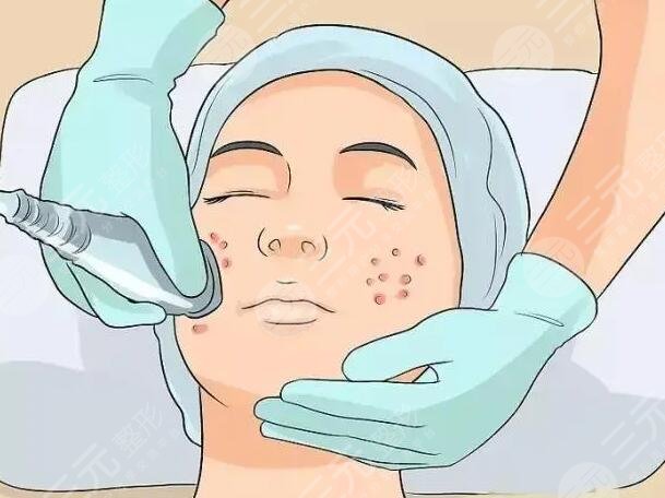 痤瘡生長的原因是什么呢?