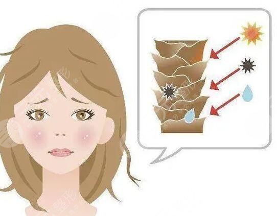 光子嫩膚去雀斑費(fèi)用貴不貴?